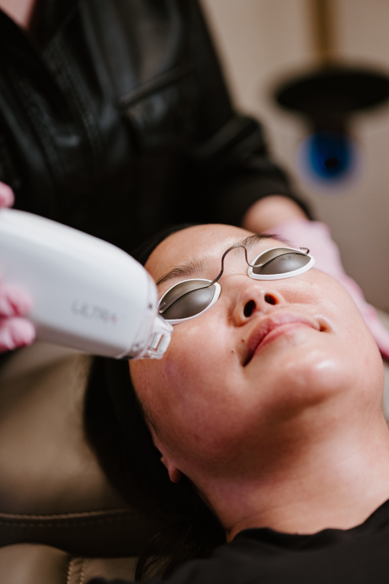 A laser facial in progress at Khlāi Medical in Hilo