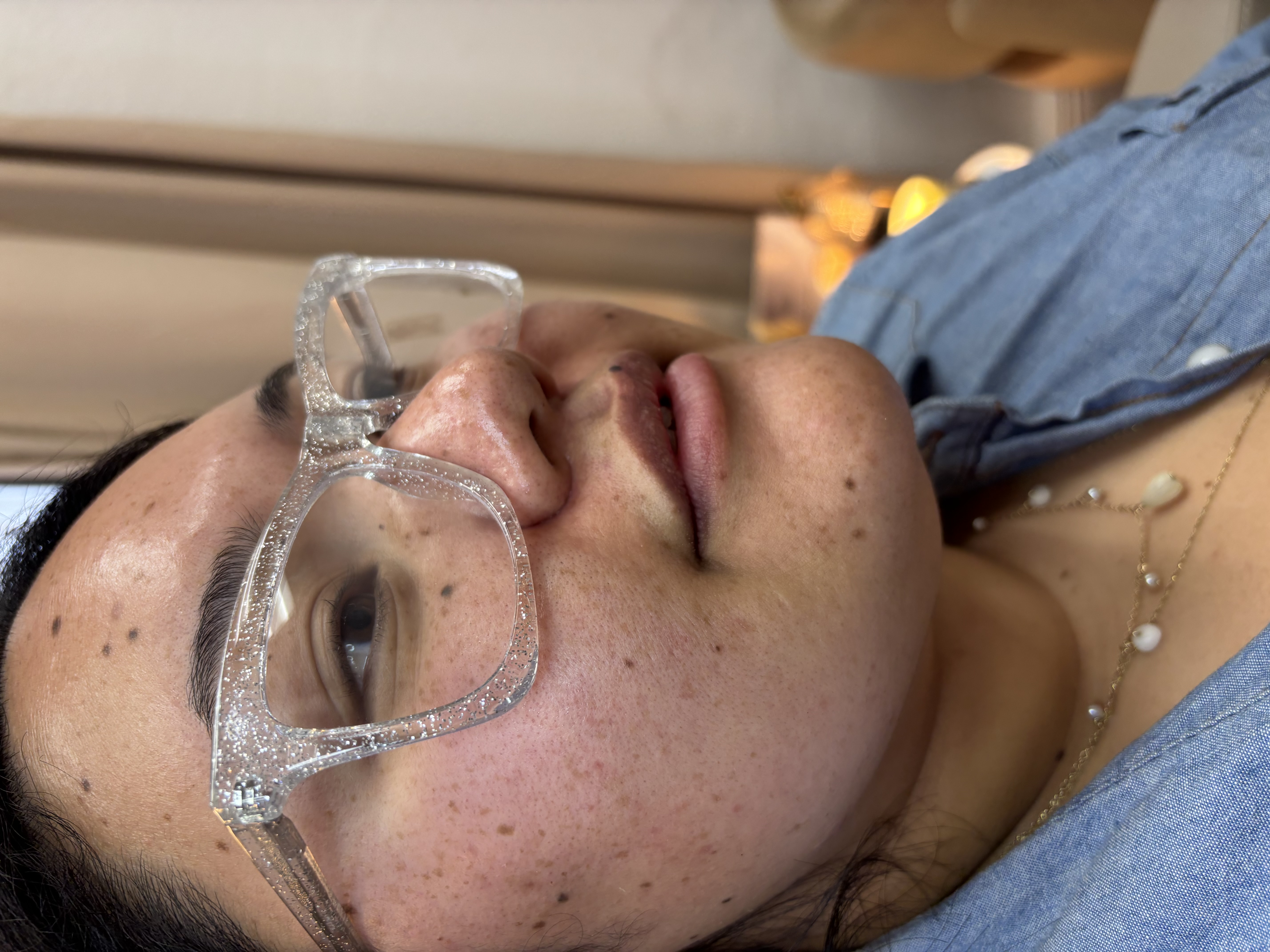 UltraMD Laser Facial treatment session